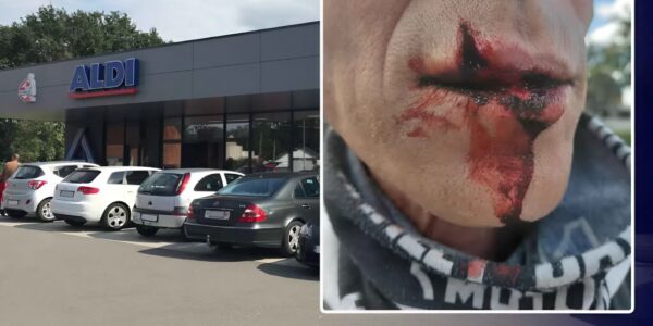 Pascal (54) Brutally Attacked at Aldi in Assenede: “Dad Couldn’t Speak Because of the Blood in His Mouth”
