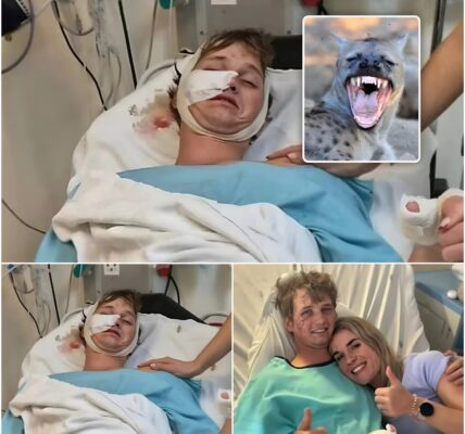 Nicolas (27) vocht zich vrij uit kaken van hyena’s: “Ze drongen mijn tent binnen en grepen mijn hoofd”