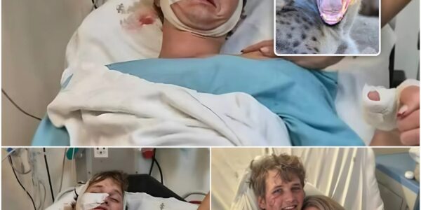 Nicolas (27) vocht zich vrij uit kaken van hyena’s: “Ze drongen mijn tent binnen en grepen mijn hoofd”