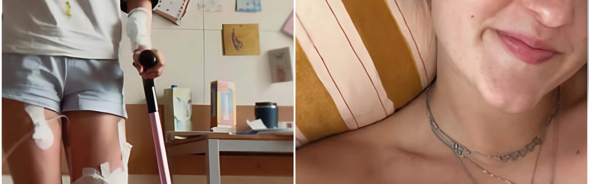 Sarah, 21, verloor haar onderbeen door een zeldzame vorm van kanker – maar de keuze ...