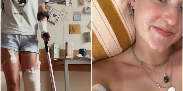 Sarah, 21, verloor haar onderbeen door een zeldzame vorm van kanker – maar de keuze ...