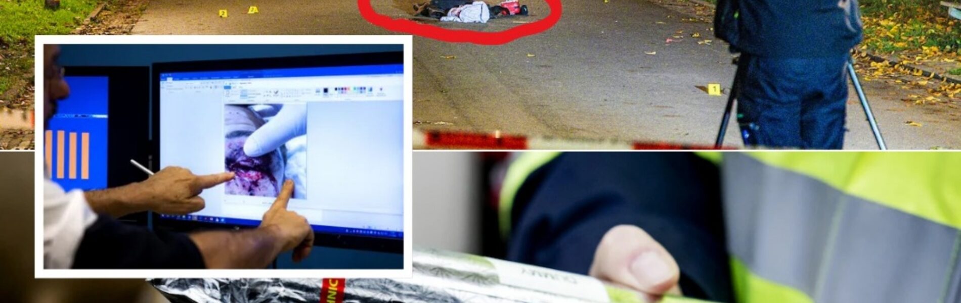 De toestand van de jongen wiens hand werd geraakt door een vuurwerkexplosie is kritiek