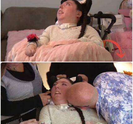 Vrouw die bijna geen hersenen heeft en nooit ouder zou worden dan 4 jaar viert 20ste verjaardag: ‘Mirakel’