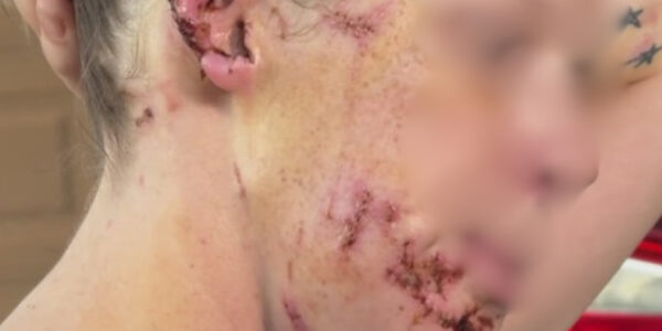 Berlinerin von eigenem Hund attackiert: „Ich hätte nie gedacht, dass er mich töten könnte“