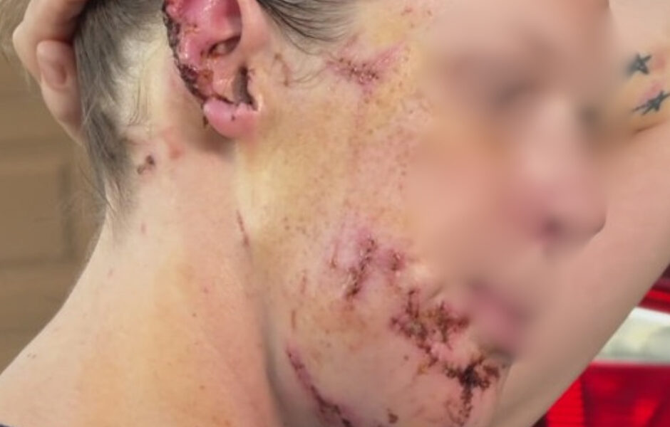 Berlinerin von eigenem Hund attackiert: „Ich hätte nie gedacht, dass er mich töten könnte“